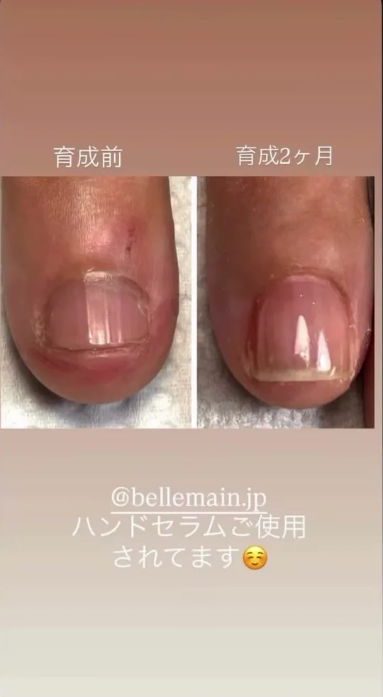 ベリュマン使用例 CASE 02(使用前・使用後)