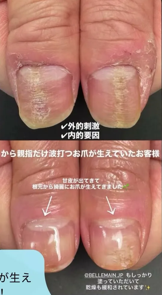 ベリュマン使用例 CASE 07（使用前・使用後）