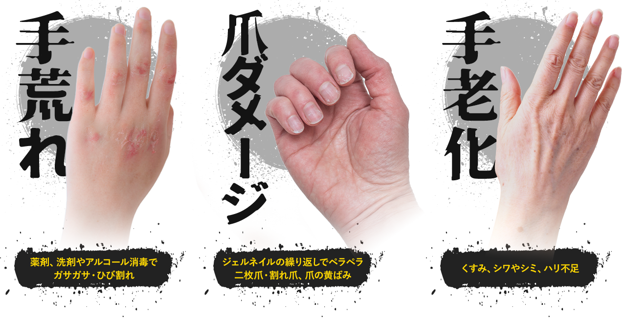 手荒れ・爪ダメージ・手老化