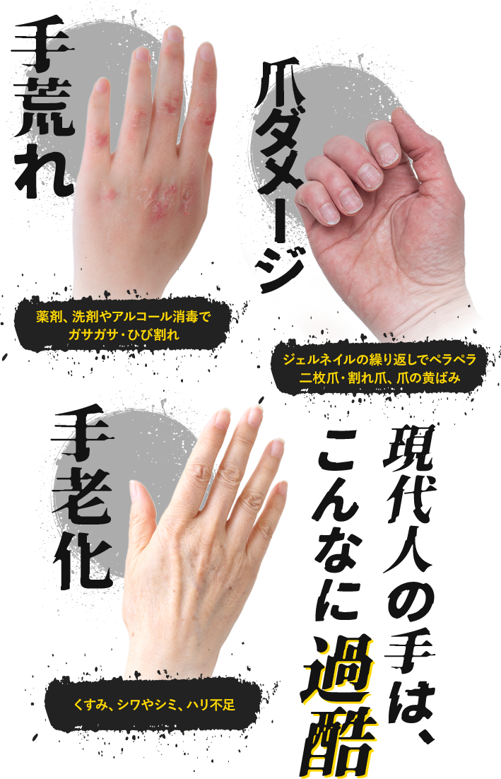 手荒れ・爪ダメージ・手老化 現代人の手は、こんなに過酷